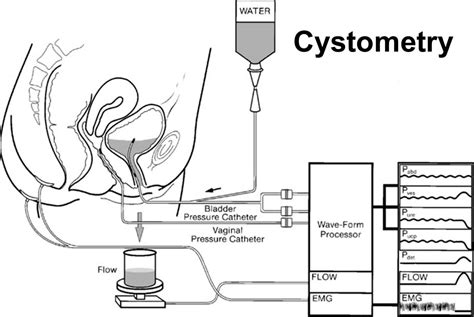 scratch test bladder|bladder cystometric tests.